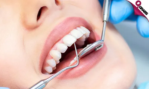Teeth Scaling, Polishing, Consultation & More!